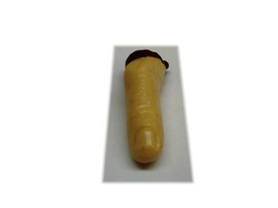 SeveredFinger